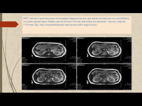 МРТ магнитті-резонанстық томография барысында көп жағдайда контрастты зат енгізбейміз, тек