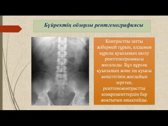 Контрастты затты жібермей тұрып, алдымен құрсақ қуысының шолу рентгенограммасы жасалады.