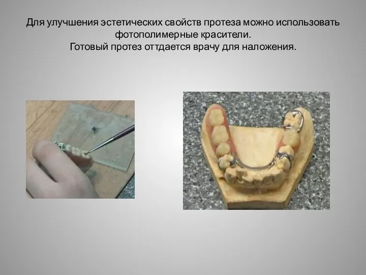 Для улучшения эстетических свойств протеза можно использовать фотополимерные красители. Готовый протез оттдается врачу для наложения.