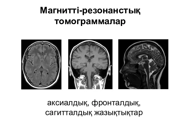 Магнитті-резонанстық томограммалар аксиалдық, фронталдық, сагитталдық жазықтықтар