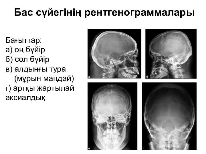 Бас сүйегінің рентгенограммалары Бағыттар: а) оң бүйір б) сол бүйір