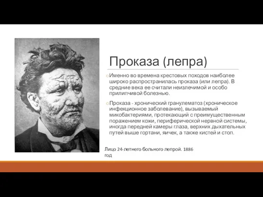 Проказа (лепра) Именно во времена крестовых походов наиболее широко распространилась