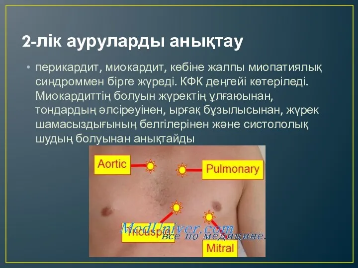 2-лік ауруларды анықтау перикардит, миокардит, көбіне жалпы миопатиялық синдроммен бірге