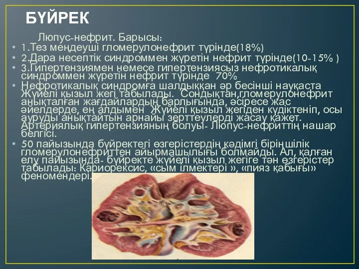 БҮЙРЕК Люпус-нефрит. Барысы: 1.Тез меңдеуші гломерулонефрит түрінде(18%) 2.Дара несептік синдроммен