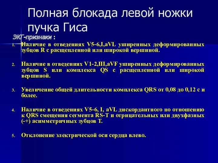 Полная блокада левой ножки пучка Гиса ЭКГ-признаки : Наличие в