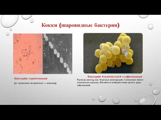 Кокки (шаровидные бактерии) Бактерии стрептококки (от греческого «стрептос» — цепочка) Бактерии «золотистые» стафилококки