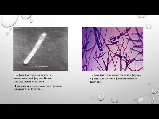 На фото бактериальная клетка палочковидной формы. Видны множественные жгутики. Фото сделано с помощью