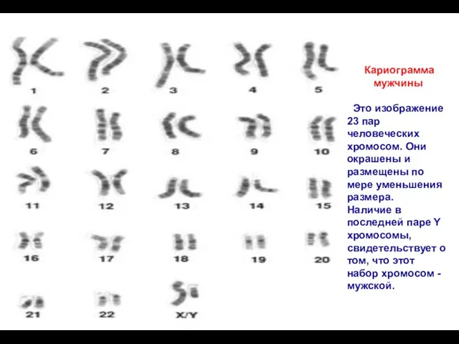 Кариограмма мужчины Это изображение 23 пар человеческих хромосом. Они окрашены