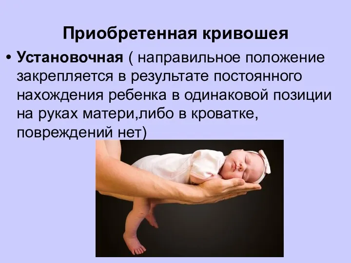Приобретенная кривошея Установочная ( направильное положение закрепляется в результате постоянного нахождения ребенка в
