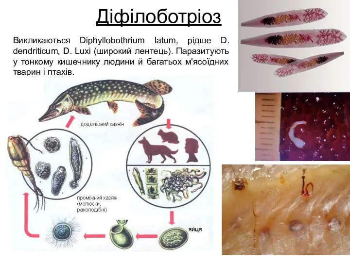 Діфілоботріоз Викликаються Diphyllobothrium latum, рідше D. dendriticum, D. Luxi (широкий