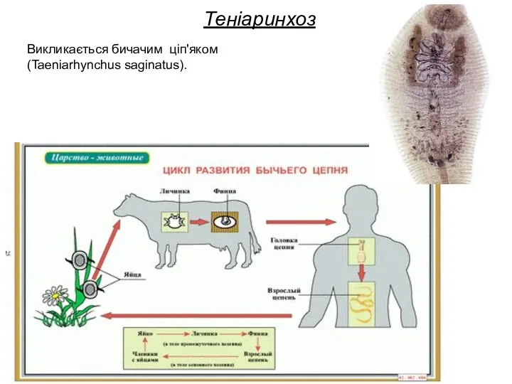 Теніаринхоз Викликається бичачим ціп'яком (Taeniarhynchus saginatus).