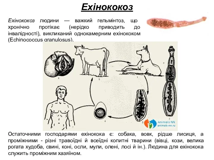 Ехінококоз Ехінококоз людини — важкий гельмінтоз, що хронічно протікає (нерідко