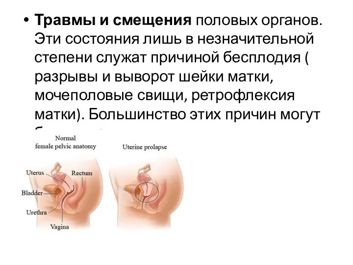 Травмы и смещения половых органов. Эти состояния лишь в незначительной