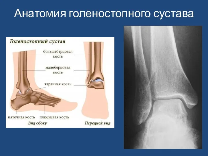 Анатомия голеностопного сустава