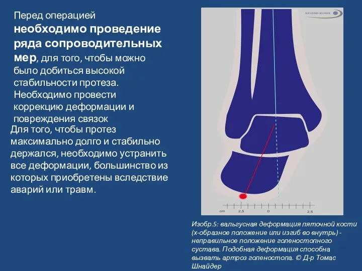 Перед операцией необходимо проведение ряда сопроводительных мер, для того, чтобы можно было добиться