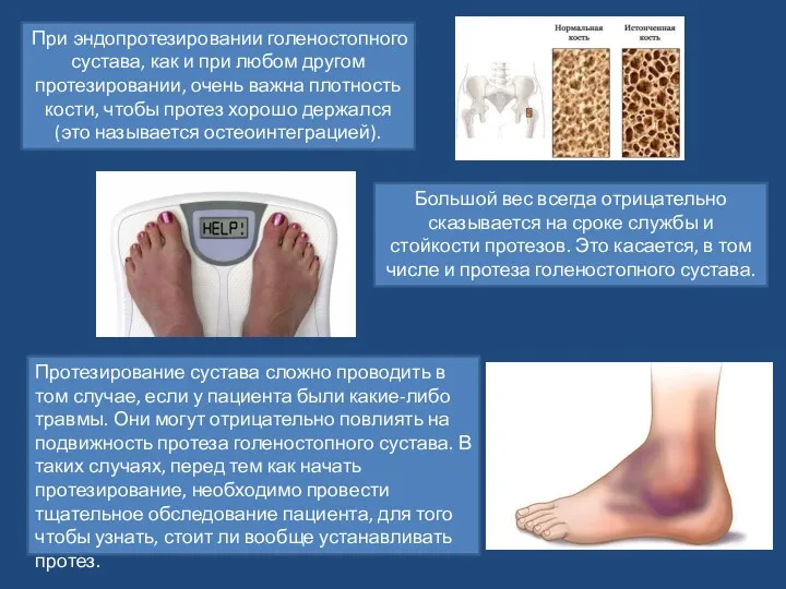 При эндопротезировании голеностопного сустава, как и при любом другом протезировании, очень важна плотность