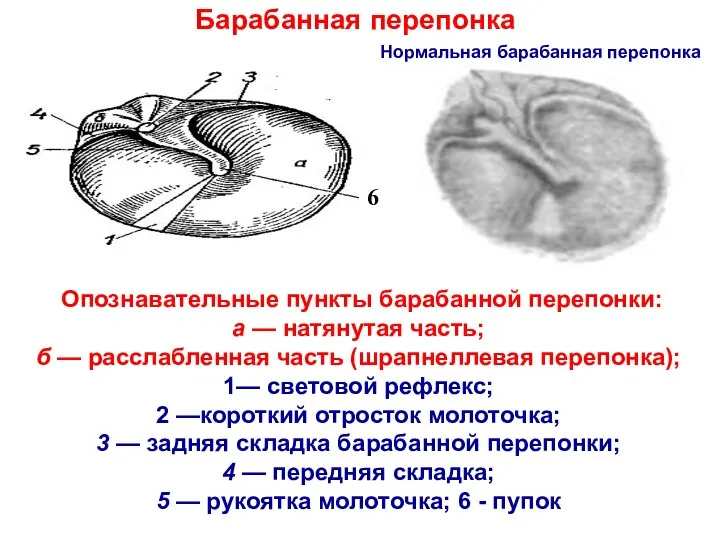 Барабанная перепонка 6 Нормальная барабанная перепонка