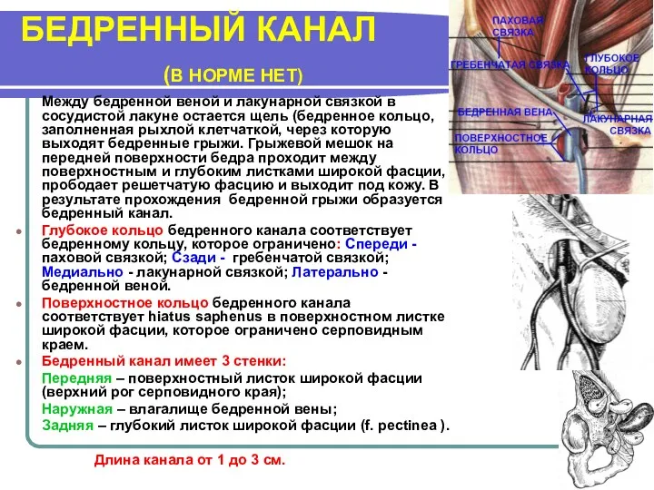 БЕДРЕННЫЙ КАНАЛ (В НОРМЕ НЕТ) Между бедренной веной и лакунарной связкой в сосудистой