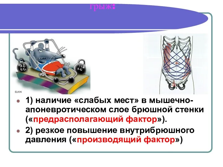 Факторы, способствующие возникновению грыж: 1) наличие «слабых мест» в мышечно-апоневротическом слое брюшной стенки