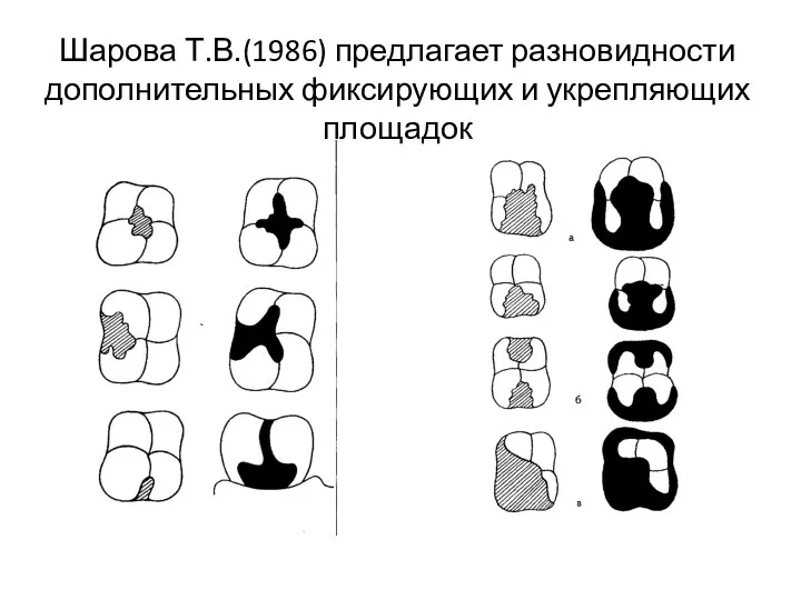 Шарова Т.В.(1986) предлагает разновидности дополнительных фиксирующих и укрепляющих площадок