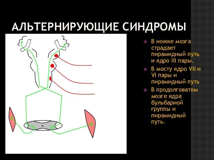 АЛЬТЕРНИРУЮЩИЕ СИНДРОМЫ В ножке мозга страдает пирамидный путь и ядро