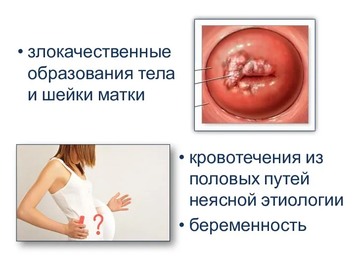 злокачественные образования тела и шейки матки кровотечения из половых путей неясной этиологии беременность