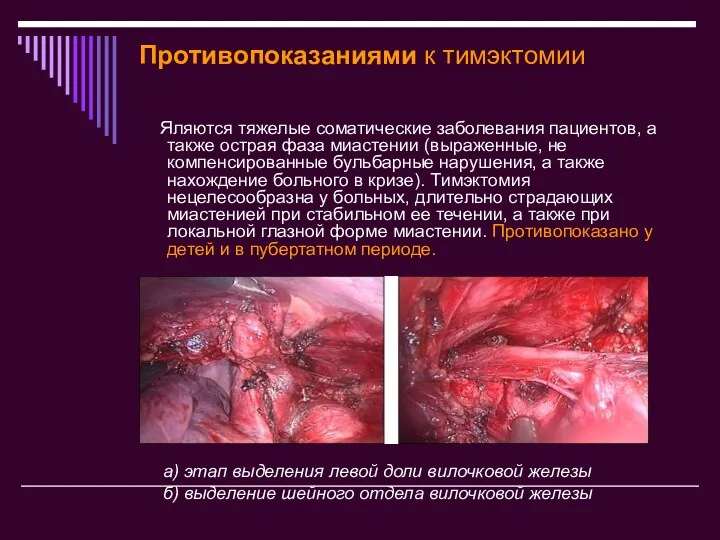 Противопоказаниями к тимэктомии Яляются тяжелые соматические заболевания пациентов, а также