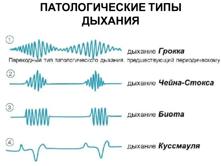 ПАТОЛОГИЧЕСКИЕ ТИПЫ ДЫХАНИЯ