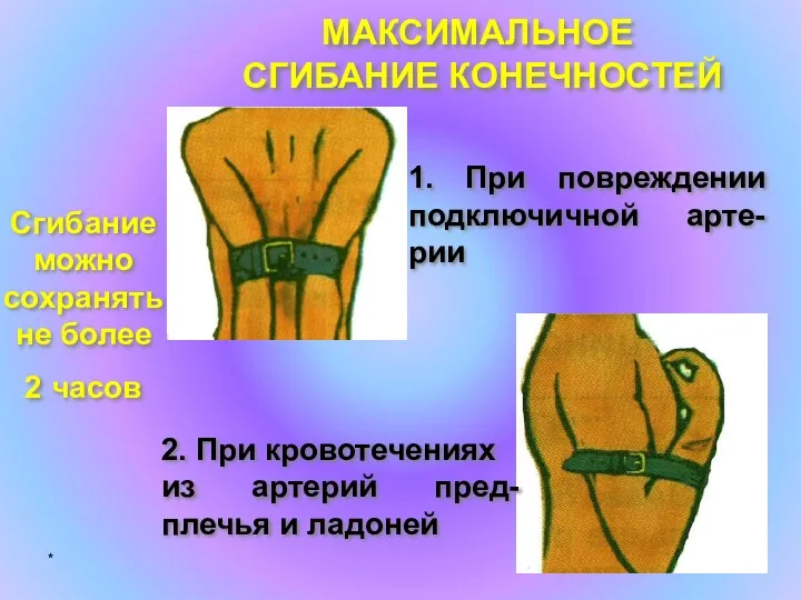 * МАКСИМАЛЬНОЕ СГИБАНИЕ КОНЕЧНОСТЕЙ 1. При повреждении подключичной арте-рии 2.