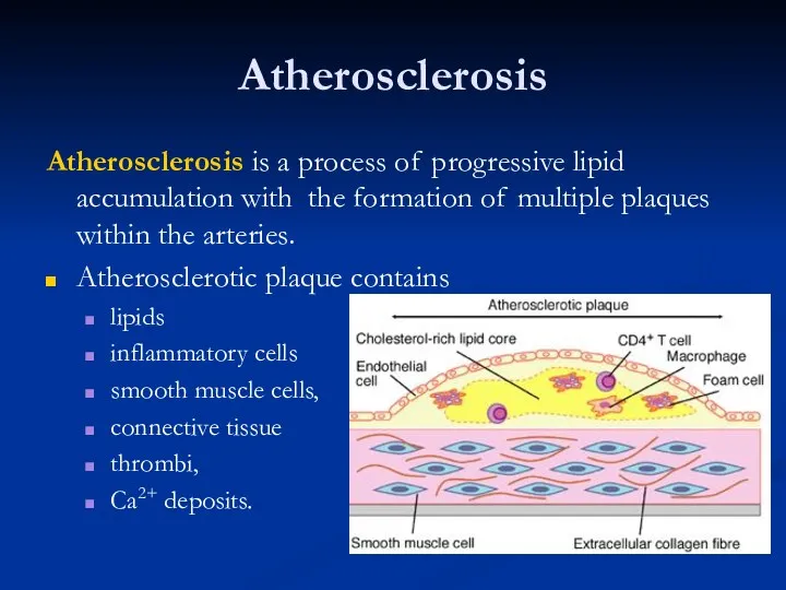 Atherosclerosis Atherosclerosis is a process of progressive lipid accumulation with