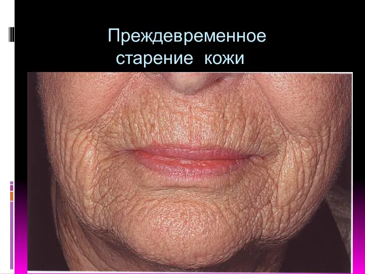 Преждевременное старение кожи
