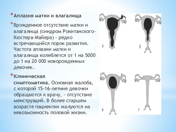 Аплазия матки и влагалища Врожденное отсутствие матки и влагалища (синдром