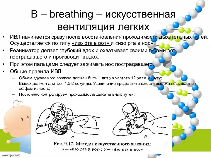 B – breathing – искусственная вентиляция легких ИВЛ начинается сразу