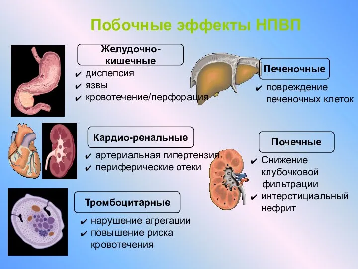 Побочные эффекты НПВП