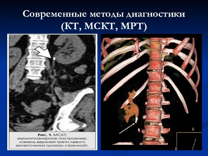 Современные методы диагностики (КТ, МСКТ, МРТ)