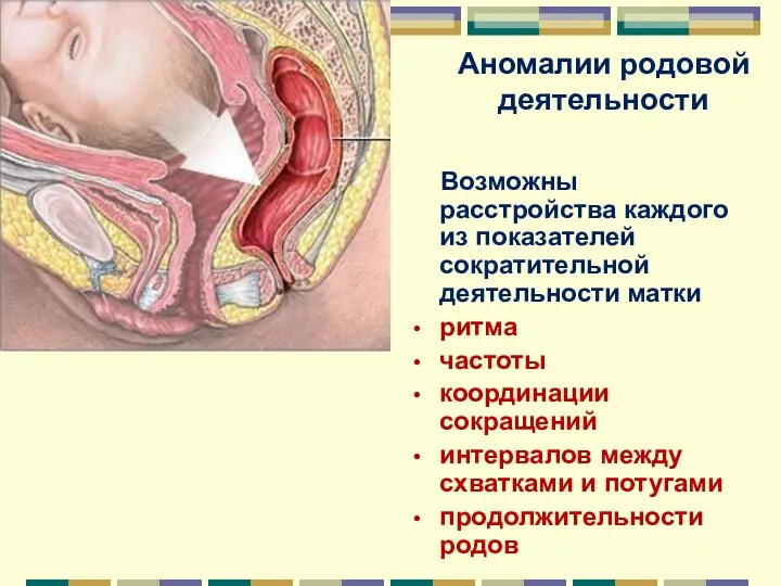 Аномалии родовой деятельности Возможны расстройства каждого из показателей сократительной деятельности