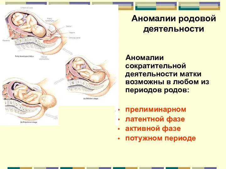 Аномалии родовой деятельности Аномалии сократительной деятельности матки возможны в любом