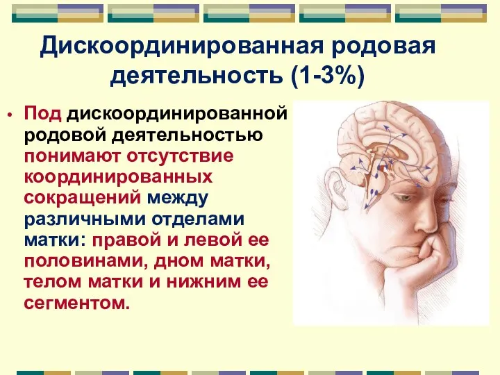 Дискоординированная родовая деятельность (1-3%) Под дискоординированной родовой деятельностью понимают отсутствие