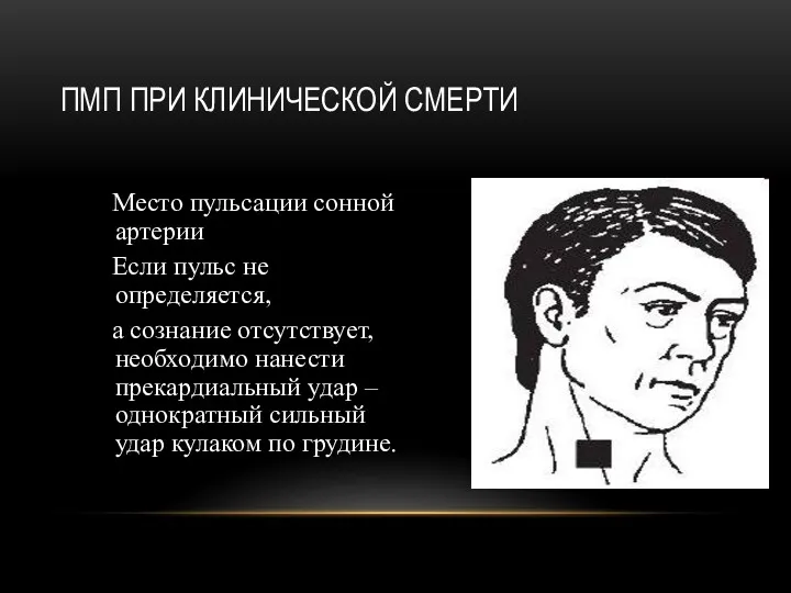 Место пульсации сонной артерии Если пульс не определяется, а сознание