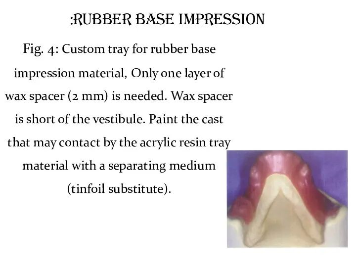 Rubber Base Impression: Fig. 4: Custom tray for rubber base impression material, Only
