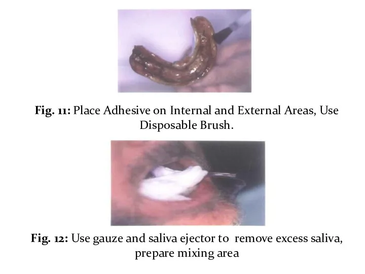 Fig. 11: Place Adhesive on Internal and External Areas, Use Disposable Brush. Fig.