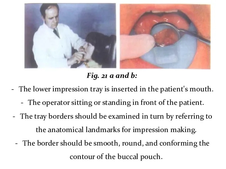 Fig. 21 a and b: The lower impression tray is inserted in the