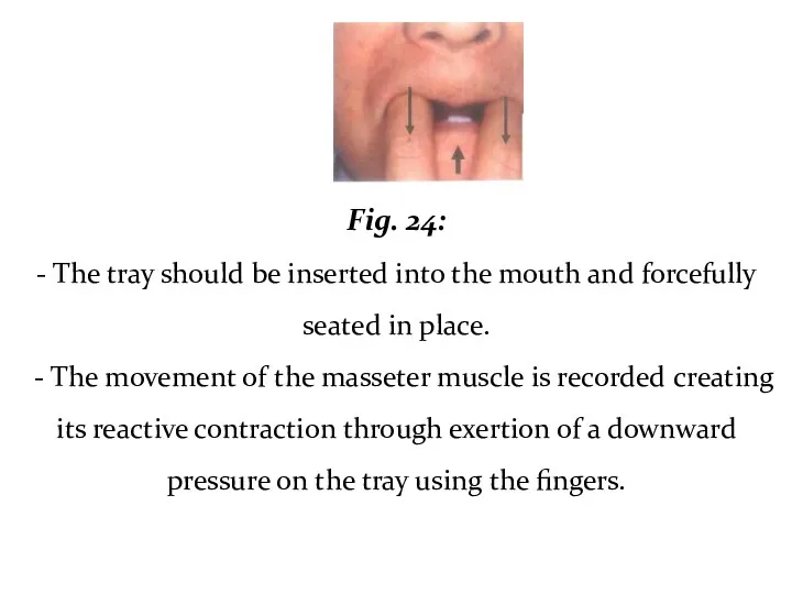 Fig. 24: - The tray should be inserted into the