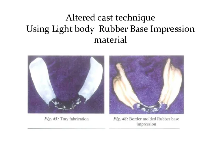 Altered cast technique Using Light body Rubber Base Impression material