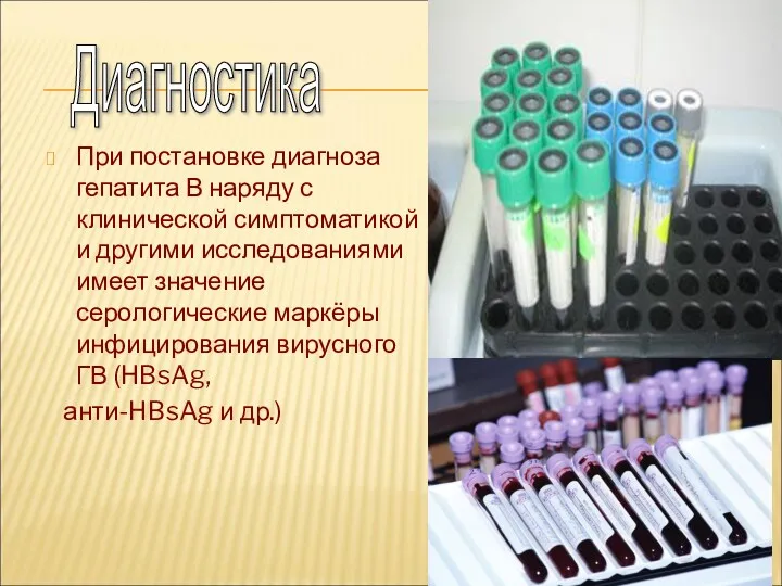 При постановке диагноза гепатита В наряду с клинической симптоматикой и