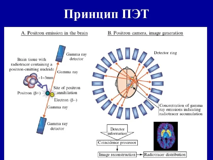 Принцип ПЭТ