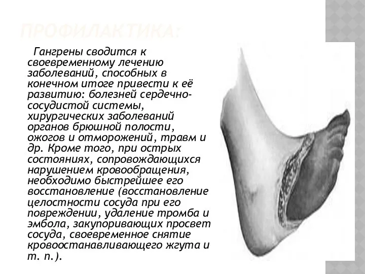 ПРОФИЛАКТИКА: Гангрены сводится к своевременному лечению заболеваний, способных в конечном