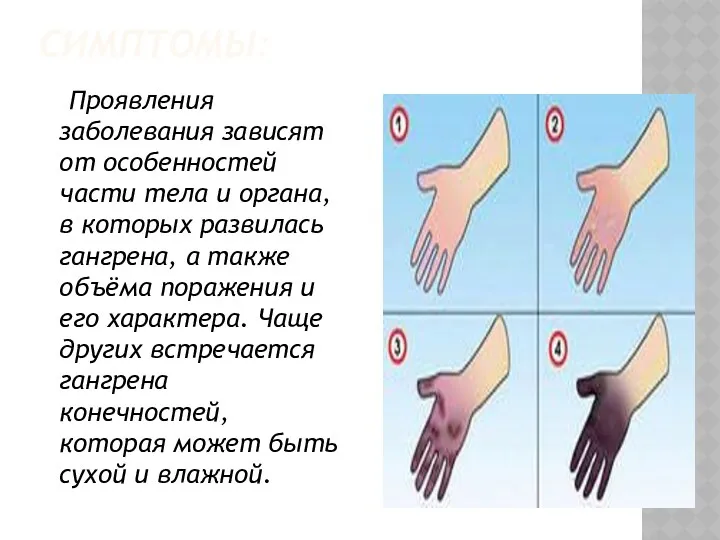 СИМПТОМЫ: Проявления заболевания зависят от особенностей части тела и органа,