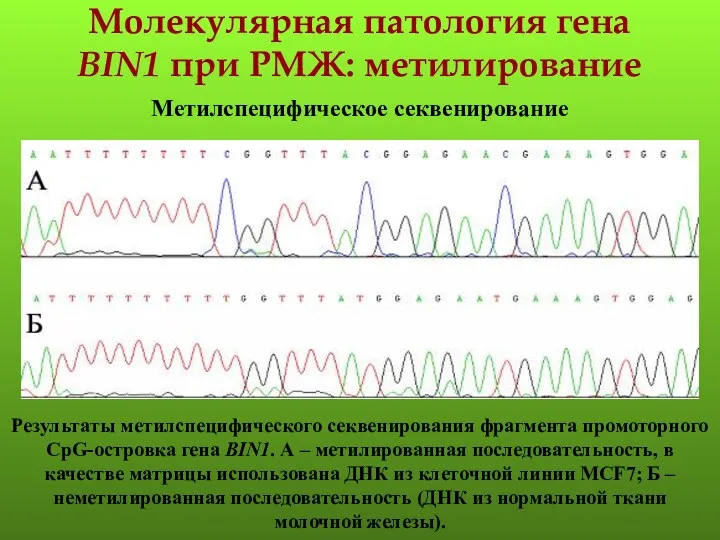 Молекулярная патология гена BIN1 при РМЖ: метилирование Метилспецифическое секвенирование Результаты