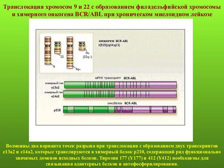 Транслокация хромосом 9 и 22 с образованием филадельфийской хромосомы и